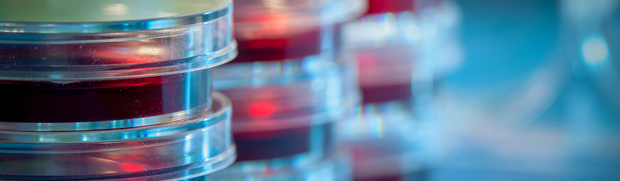 Labatory Petri Dishes